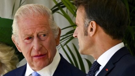 Ο βασιλιάς Κάρολος στη συνάντηση με τον Μακρόν με κατακόκκινο μάτι – Η εξήγηση του Παλατιού (Εικόνα)