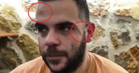 Γνωστός YouTuber δέχτηκε άγρια επίθεση σε live στα Γιάννενα – Bίντεο ντοκουμέντο