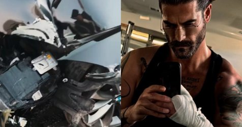 Άρης Μουγκοπέτρος: Νέο σοβαρό τροχαίο μετά τον τραυματισμό από κροτίδα – «Ζω από θαύμα» (βίντεο)