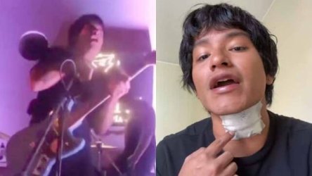 Σοκαριστικό βίντεο: Τραγουδιστής στο Περού ακούμπησε το μικρόφωνο και έπαθε ηλεκτροπληξία