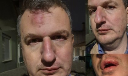 Άγριος ξυλοδαρμός εκδότη: Το σκηνικό στη Μαγνησία