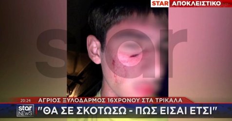 Τρίκαλα: Άγριος ξυλοδαρμός 16χρονου σε πανηγύρι επειδή «δεν άρεσαν τα ρούχα του»