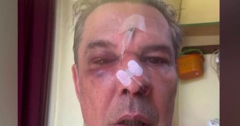 Χαϊδάρι: Σοκαριστικός ξυλοδαρμός σε ιατρείο – Του επιτέθηκε επειδή του έκανε παρατήρηση να μιλά πιο σιγά στο κινητό