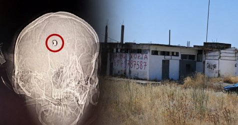 Άργος: Σε ευθεία βολή παραπέμπει η μαγνητική εγκεφάλου του 20χρονου – 21 πυροβολισμοί